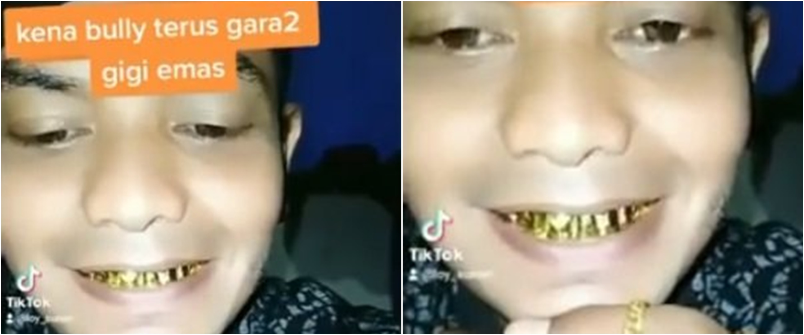 Viral cowok pamer perhiasan hingga gigi emas, gusi sampai bengkak