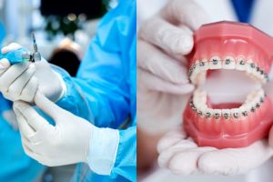 Hukum cabut, tambal, dan rawat gigi saat puasa Ramadhan menurut MUI