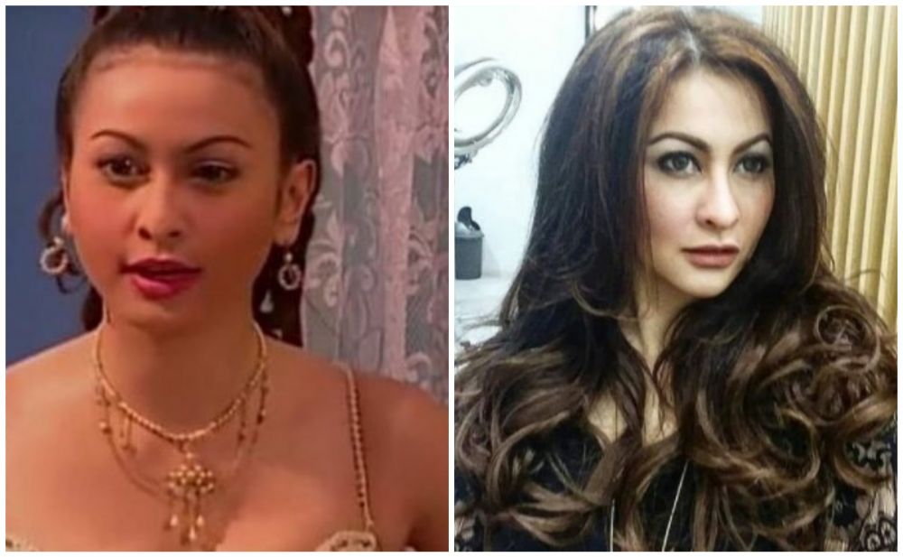 Beda penampilan 11 seleb sebelum & sesudah filler, ada yang awet muda