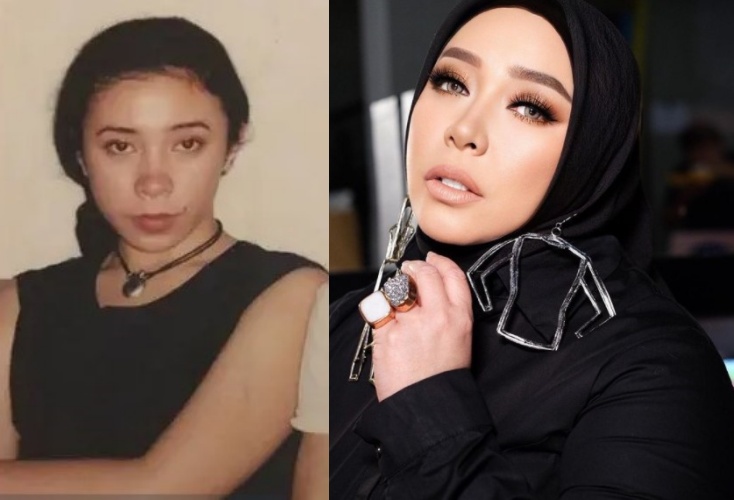 Cerita 7 penyanyi wanita Indonesia blak-blakan lakukan operasi plastik