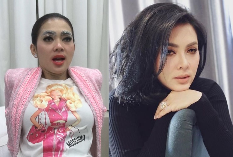 Penampilan 6 seleb sebelum & sesudah sulam bibir, Sarwendah disorot