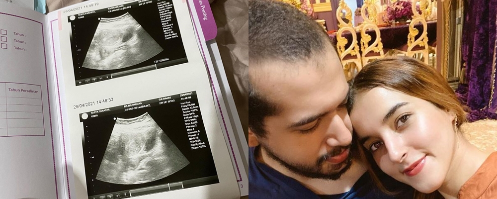 Curahan hati Tasya Farasya alami keguguran di kehamilan kedua