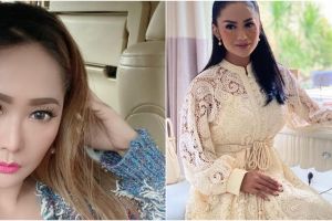 Perawatan unik 5 seleb cantik, Krisdayanti suntik DNA ikan salmon