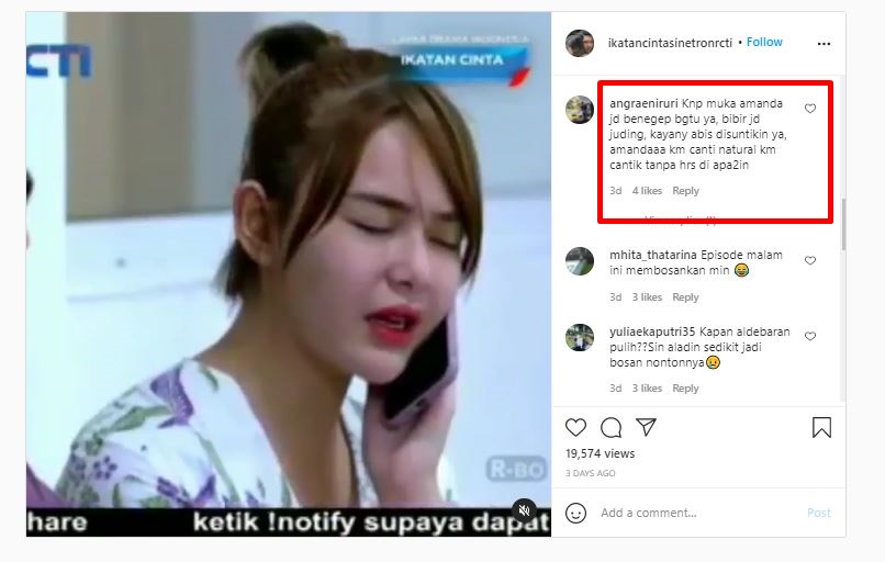 5 Potret perubahan wajah Amanda Manopo usai suntik bibir dan dagu