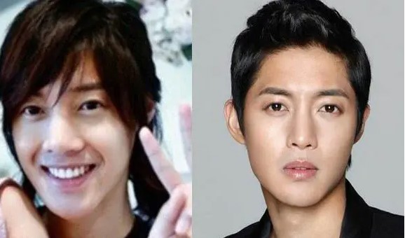 Potret 8 seleb pria Korea sebelum dan sesudah oplas, makin ganteng