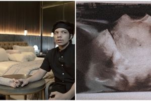 Tahan tangis, Aurel Hermansyah ungkap kronologi saat keguguran