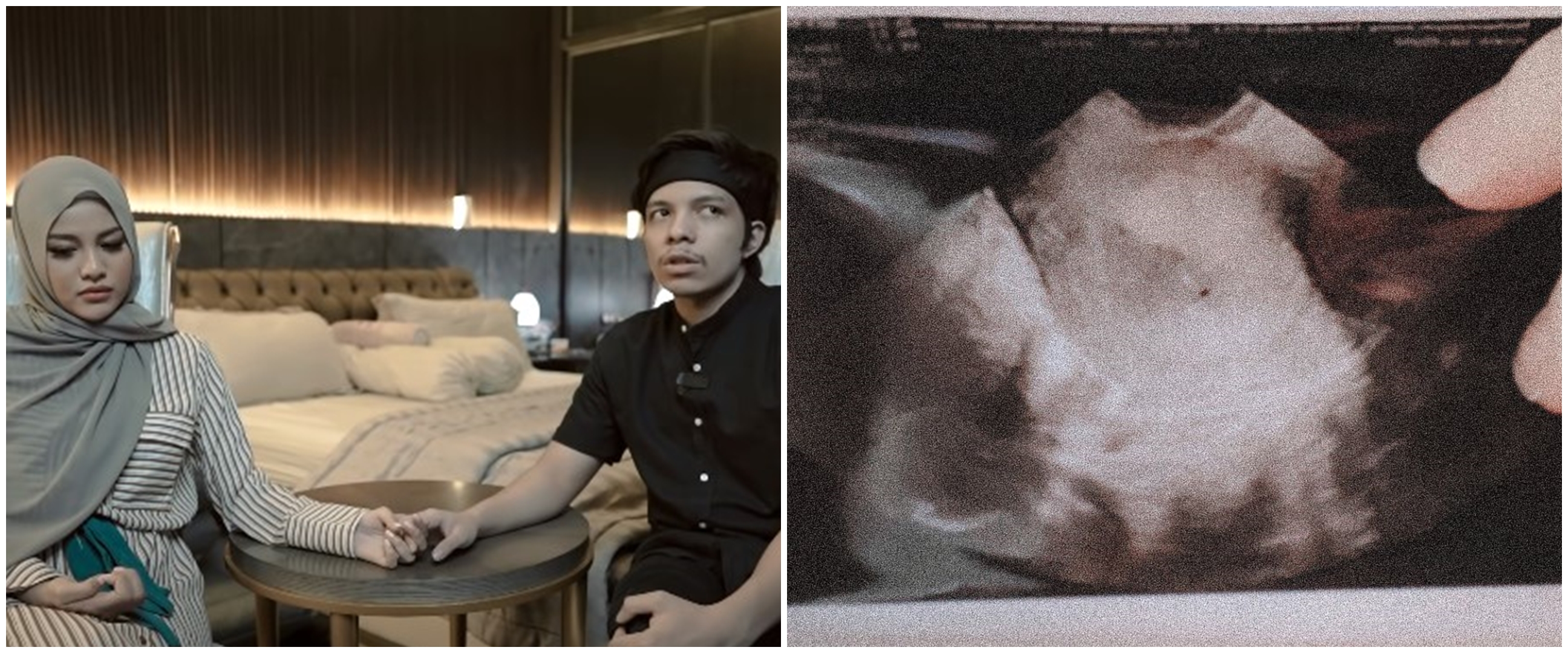 Tahan tangis, Aurel Hermansyah ungkap kronologi saat keguguran