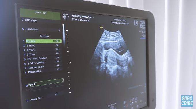 10 Momen Kesha Ratuliu umumkan kehamilan anak pertama, penuh haru