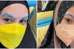 7 Potret terbaru Kartika Putri usai lakukan laser alis
