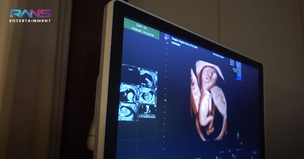 10 Momen Nagita Slavina cek USG 4D, potret calon bayi curi perhatian