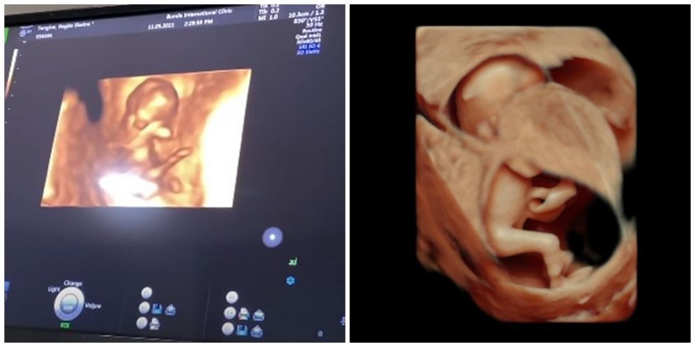 10 Momen Nagita Slavina cek USG 4D, potret calon bayi curi perhatian