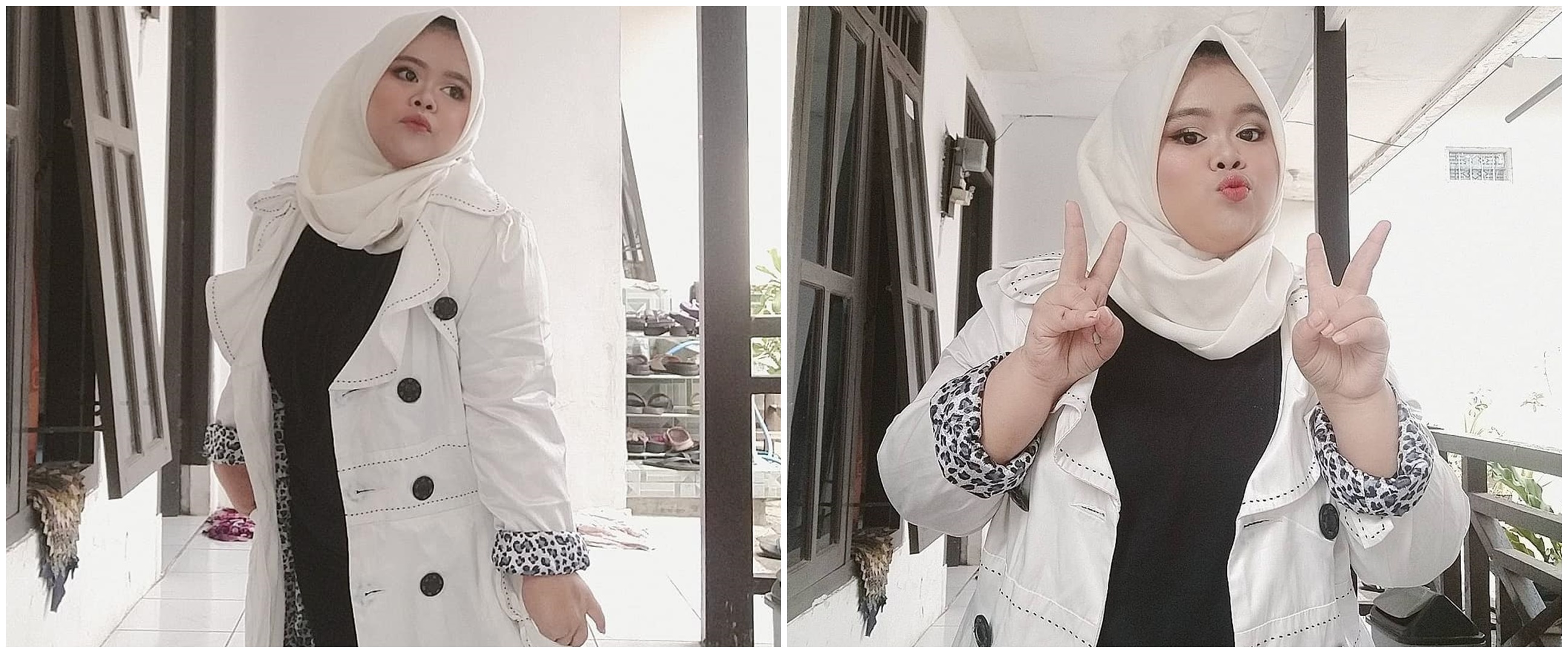 7 Potret Kekeyi jalani filler hidung, dipuji makin cantik