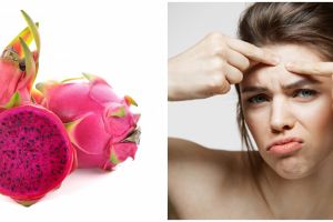 10 Manfaat buah naga untuk kecantikan, bantu kurangi jerawat