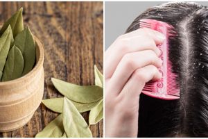 6 Manfaat daun salam untuk kecantikan, atasi ketombe