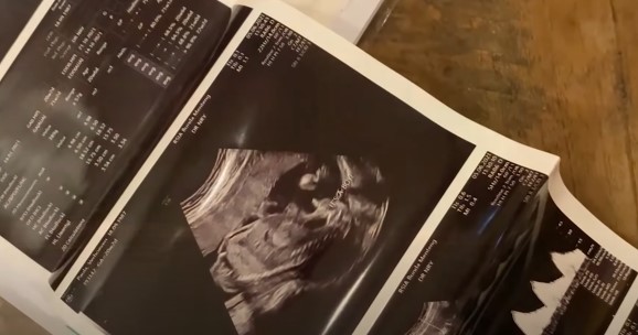 8 Momen bahagia Baim Wong ungkap jenis kelamin anak kedua, penuh haru