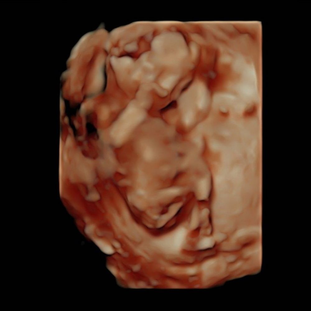 Felicya Angelista unggah foto USG, paras sang bayi bikin penasaran