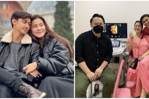 Felicya Angelista unggah foto USG, paras sang bayi bikin penasaran