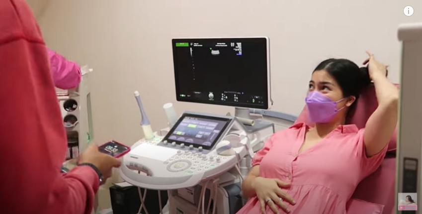 10 Momen Felicya Angelista cek kandungan, foto USG-nya curi perhatian