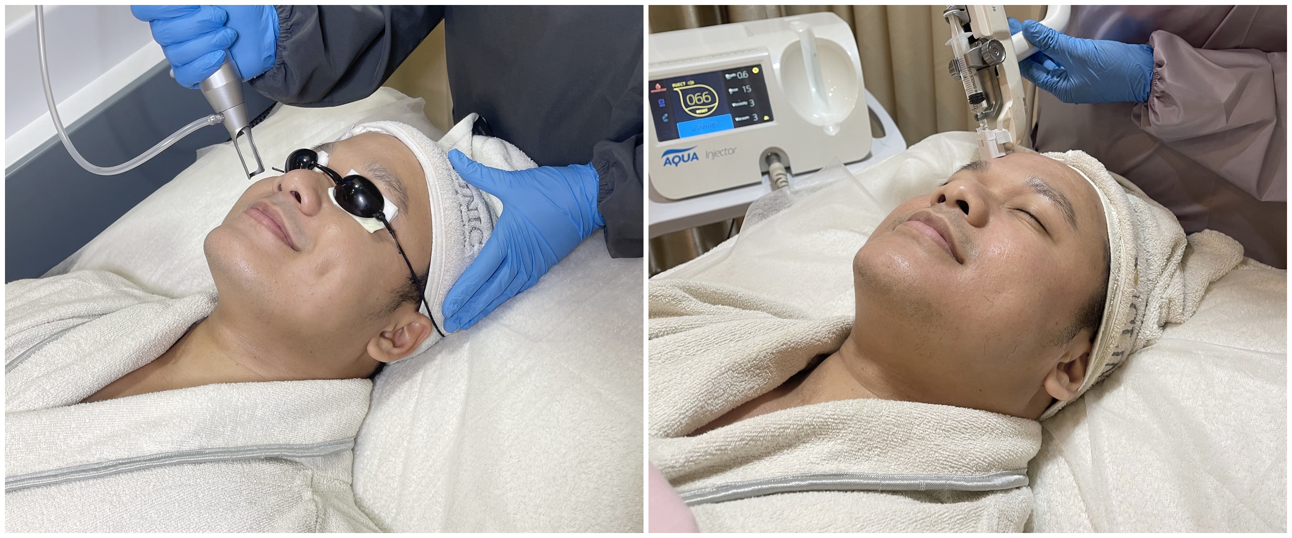 3 Perawatan unggulan di B Clinic X Tities Sapoetra, glowing & kinclong