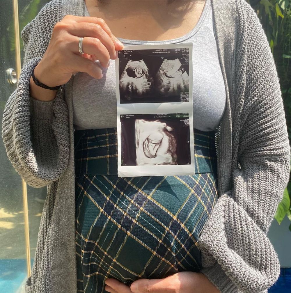 7 Momen Nola B3 umumkan kehamilan calon anak keempat, penuh haru