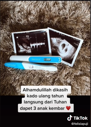 Kisah pernikahan pasangan ini bikin salut, kini punya anak kembar 3