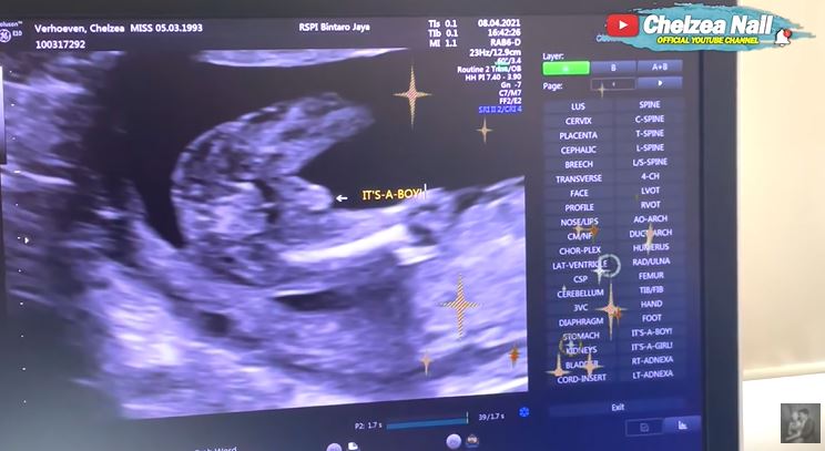 9 Momen persiapan Chelzea Verhoeven jelang lahiran, kamarnya bak toko