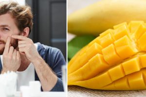 9 Manfaat mangga untuk kecantikan, bisa cegah munculnya jerawat