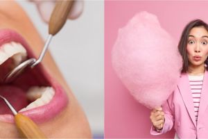 7 Penyebab munculnya karang gigi dan cara alami mengatasinya