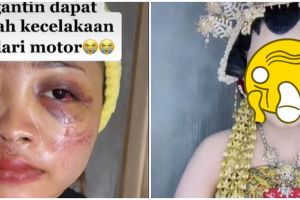 Kisah pengantin kecelakaan H-3 nikahan, hasil makeupnya bikin takjub