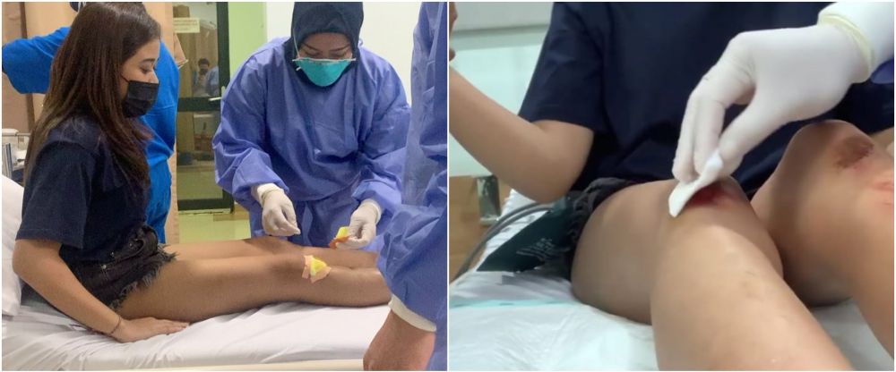 7 Potret kondisi Brisia Jodie dan Julian Jacob usai kecelakaan otopet