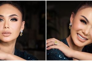 Unggah potret terbaru, hidung Yuni Shara jadi sorotan