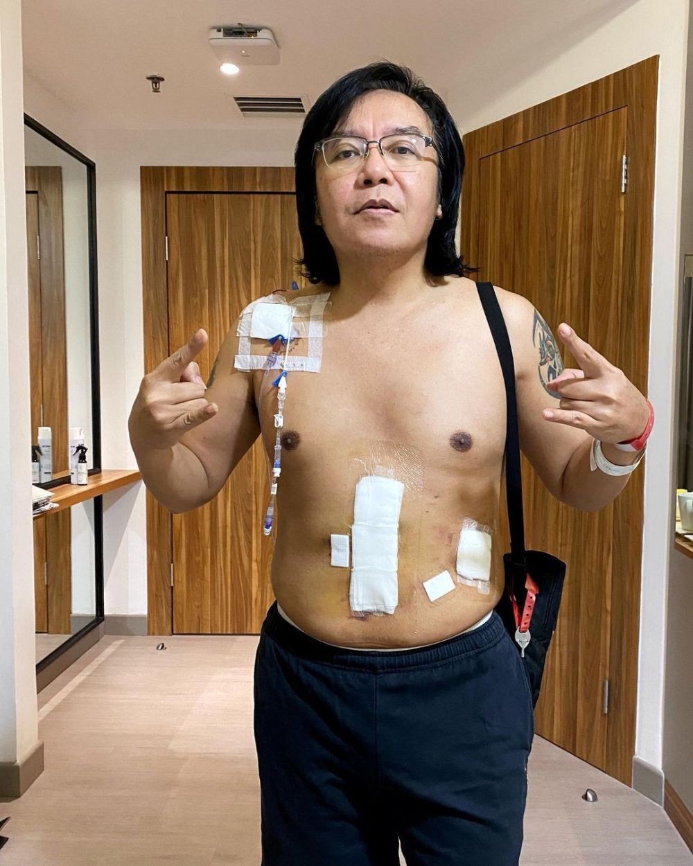 Cerita Ari Lasso ungkap kronologi operasi pengangkatan tumor di perut