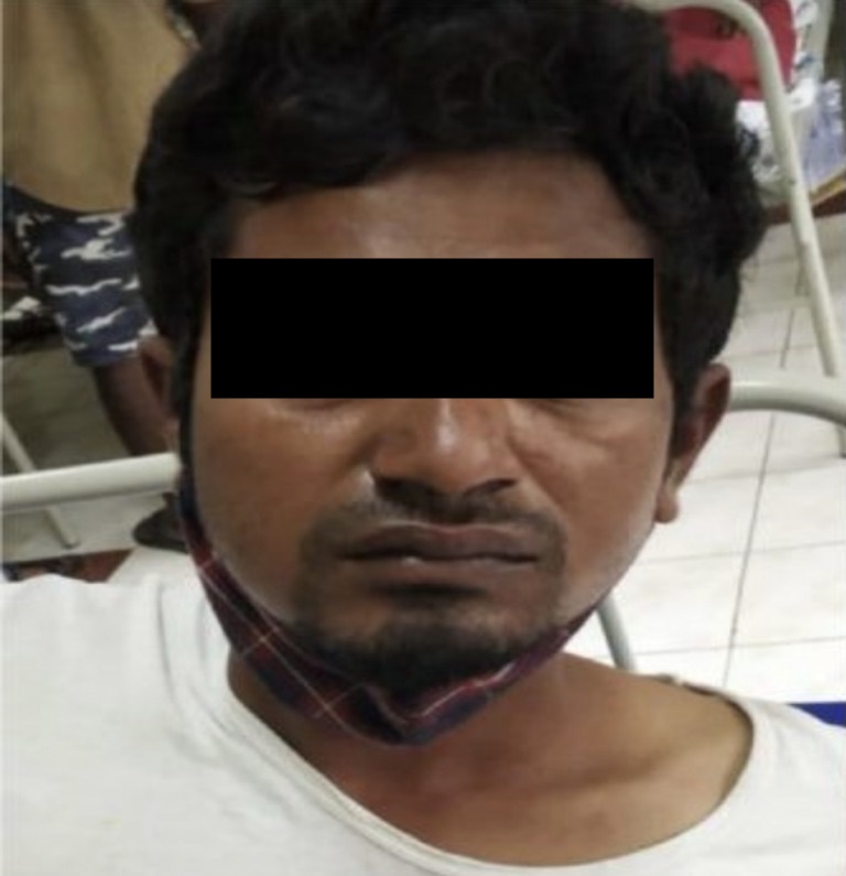 Pencuri di India ini nekat telan potong rantai emas agar tak ketahuan