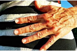 7 Makanan ini baik untuk kesehatan perut, cegah tumor dan kanker