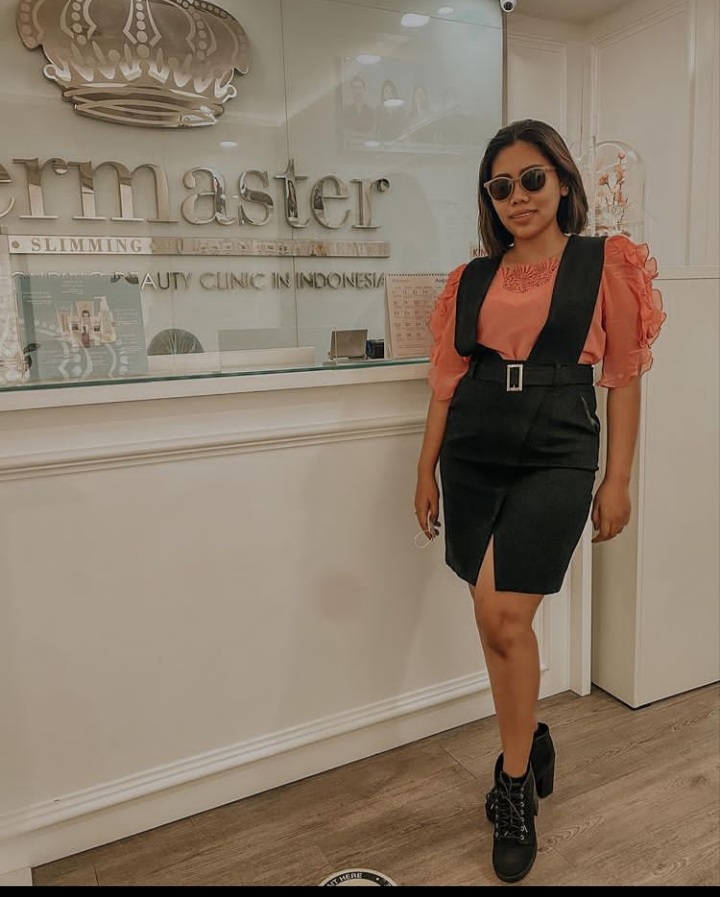 5 Perawatan kecantikan Evi Masamba, seminggu sekali harus ke dokter