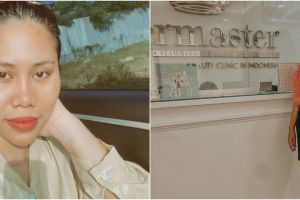 5 Perawatan kecantikan Evi Masamba, seminggu sekali harus ke dokter