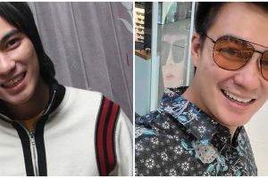 Rambutnya pernah nyentrik, ini 7 beda gaya dulu dan kini Baim Wong