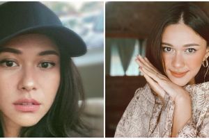 Nana Mirdad berbagi cara atasi jerawat, ketenangan diri adalah kunci