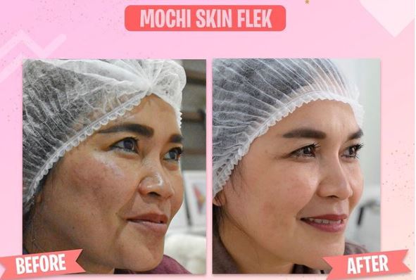 9 Momen orang tua Ayu Ting Ting perawatan kecantikan, rutin sejak 2018