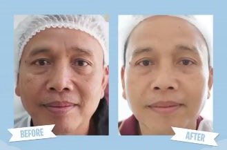 9 Momen orang tua Ayu Ting Ting perawatan kecantikan, rutin sejak 2018
