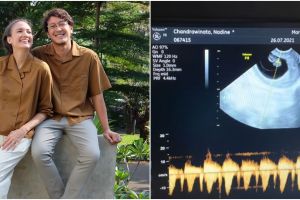 Dengarkan detak jantung janin, respons Dimas Anggara bikin ketawa