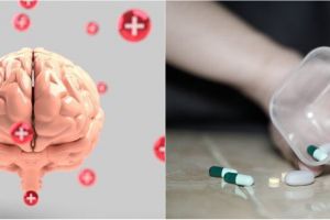 Mengenal penyakit aneurisma otak, gejala dan cara penyembuhannya