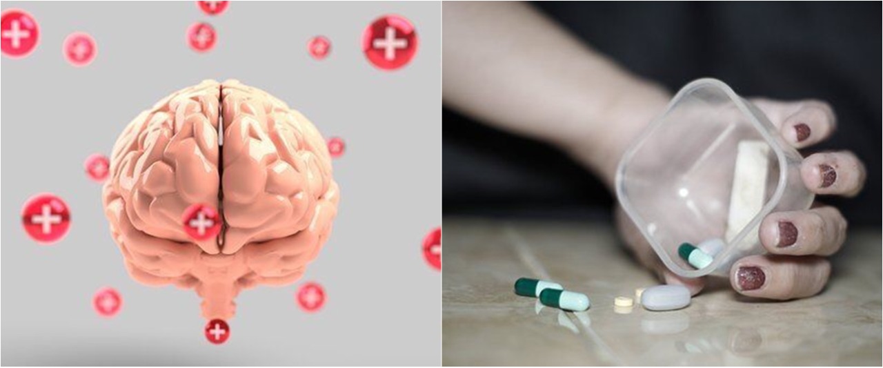 Mengenal penyakit aneurisma otak, gejala dan cara penyembuhannya