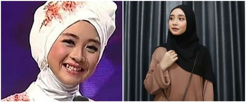 Hits sebagai pedangdut, ini 7 potret dulu dan kini Ega D'Academy