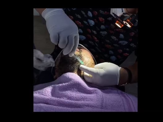 Hilangkan kerutan, ini 7 momen Raffi Ahmad perawatan wajah