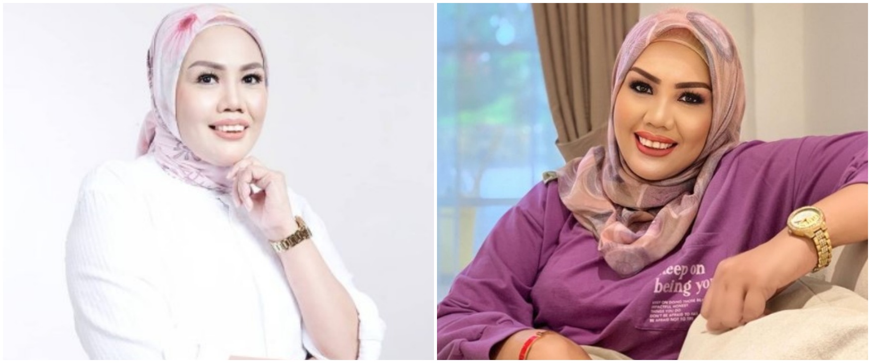 5 Potret Elly Sugigi sebelum dan sesudah perawatan kecantikan