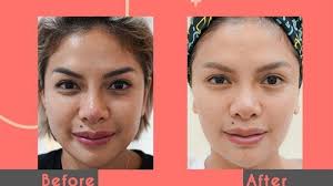 Makin glowing usia 35 tahun, ini 7 perawatan kecantikan Nikita Mirzani