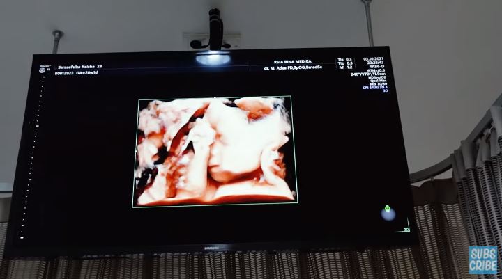 9 Momen Kesha Ratuliu cek kandungan, Mona histeris lihat hasil USG