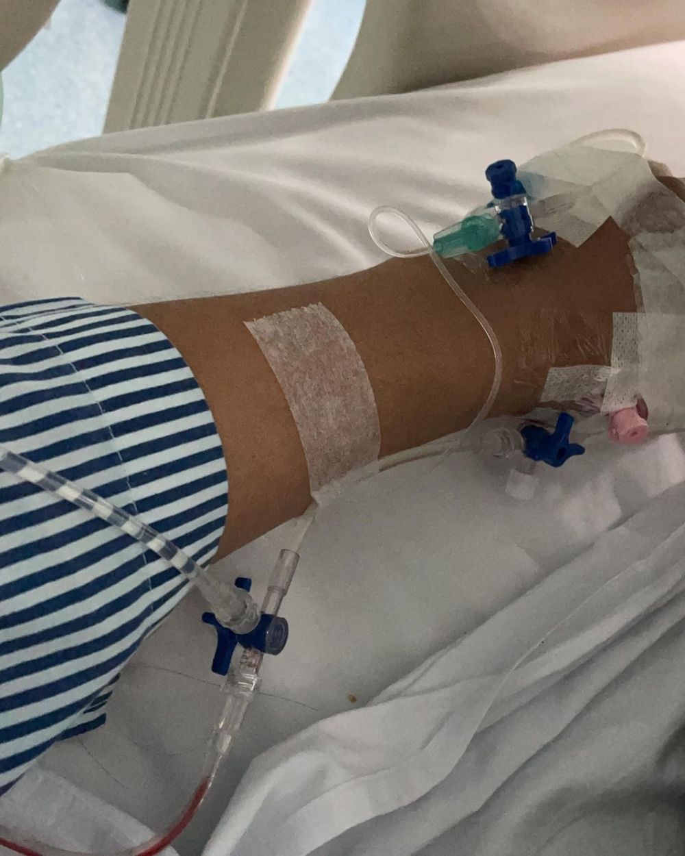 Kisah Chicco Jerikho sempat kritis dan pasang alat demi bertahan hidup