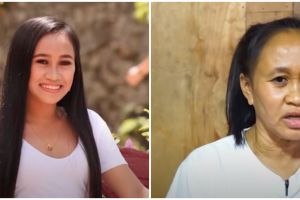 Gadis 16 tahun tampak seperti nenek akibat kondisi langka progeria